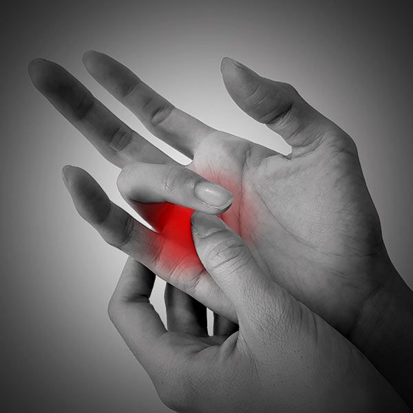 Trigger Finger (or Thumb)